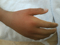 ᡼ 6